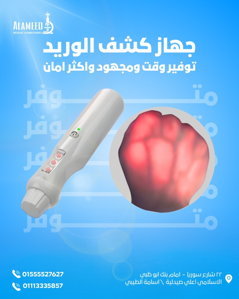 جهاز كشف الوريد